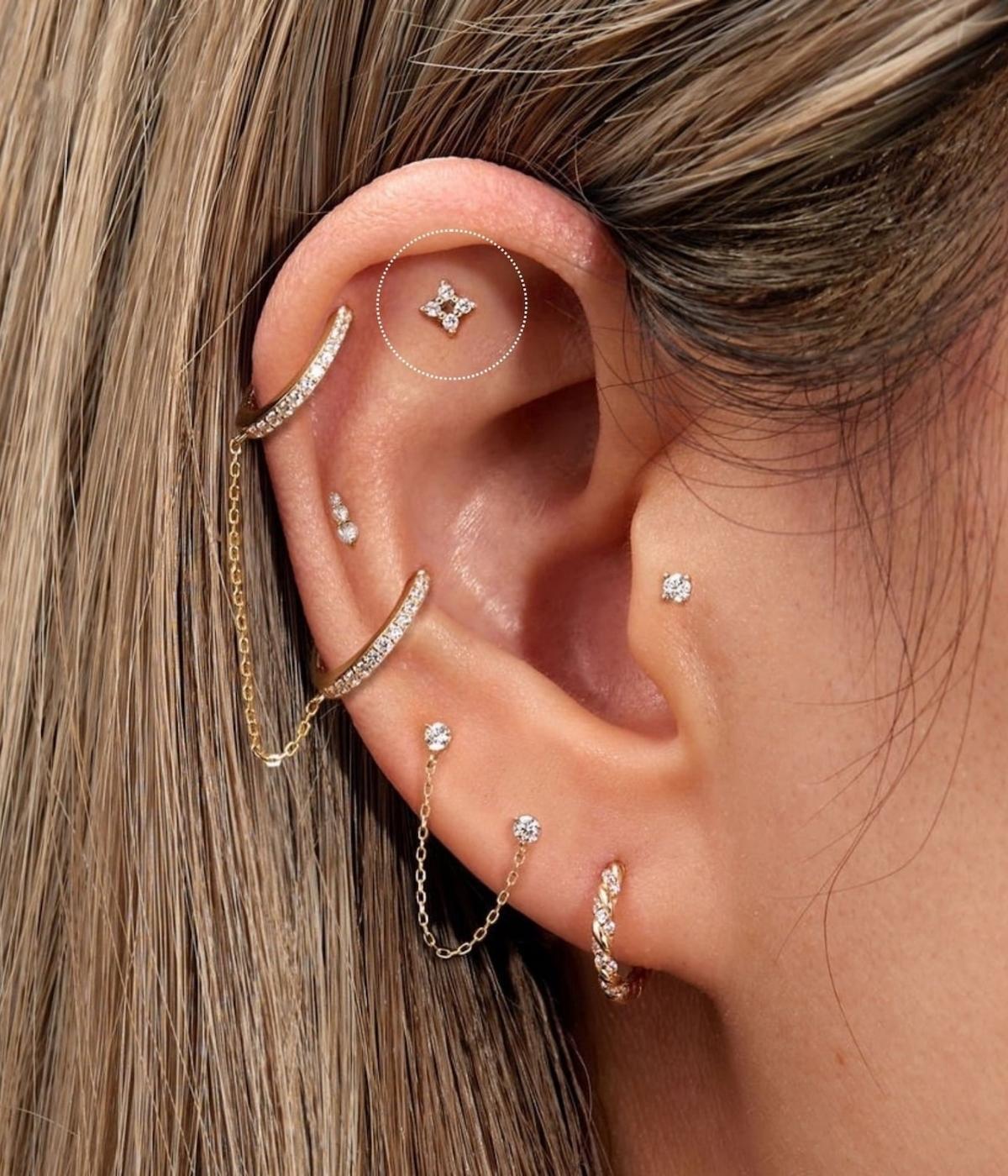 The Tetrad Diamonds